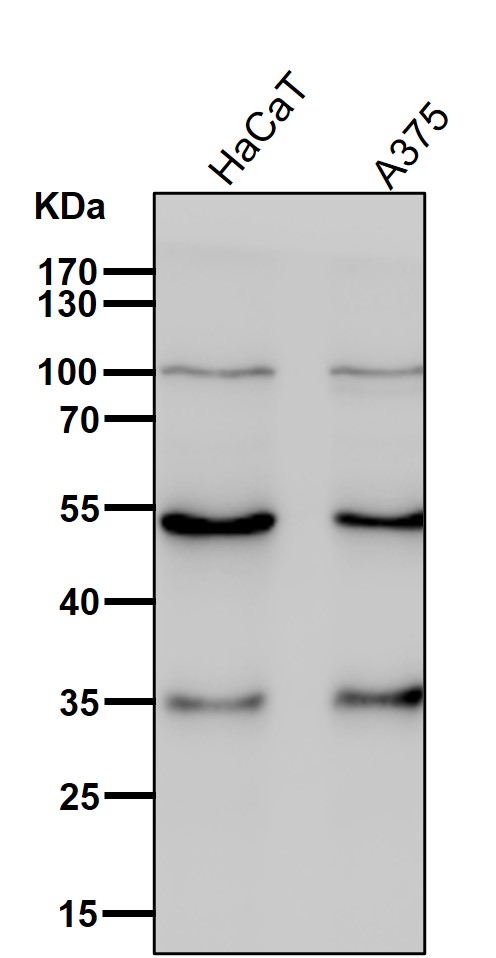 ACVR1B Ab