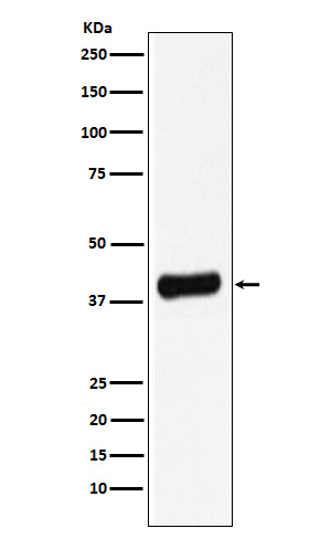 Galectin 8 Ab