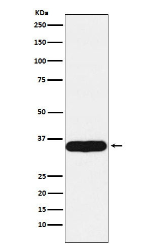 Tropomyosin 1 Ab