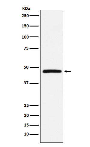 Atypical chemokine receptor 1 Ab