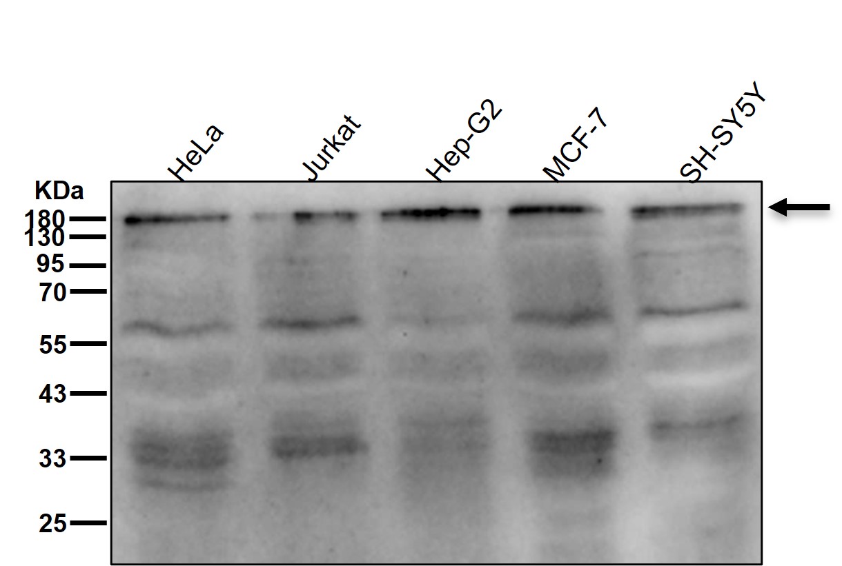 Niemann pick C1 Ab