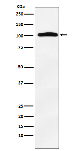 Thyroid peroxidase Ab