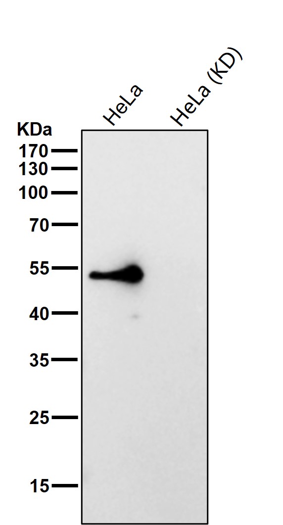 IL 13 receptor alpha 1 Ab