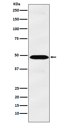 IL 13 receptor alpha 1 Ab