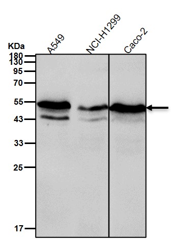 IL 13 receptor alpha 1 Ab