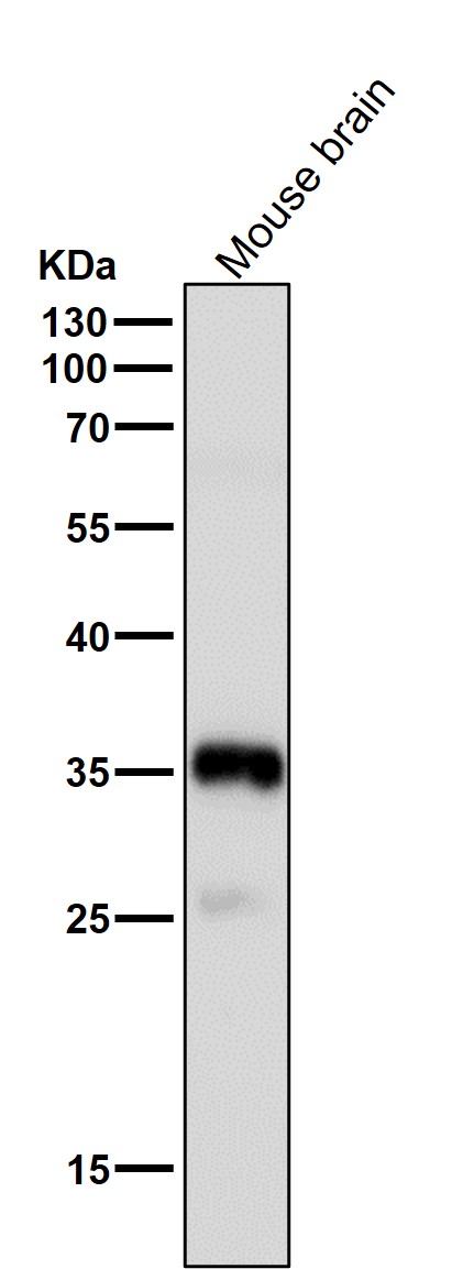 p-Nucleophosmin (S125) Ab