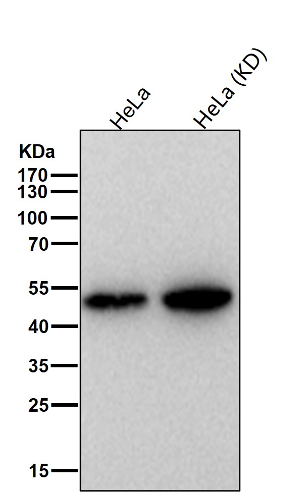 Cytochrome P450 17A1 Ab