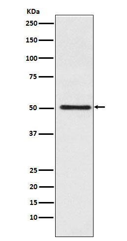 Cytochrome P450 17A1 Ab