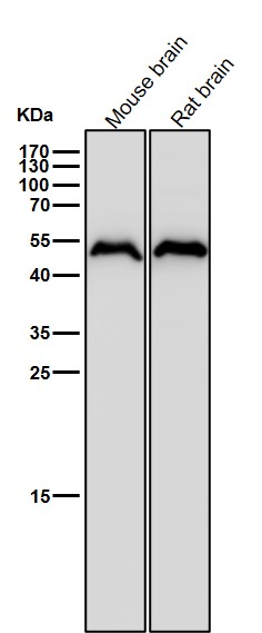 Cytochrome P450 17A1 Ab