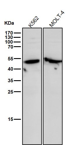 Cytochrome P450 17A1 Ab