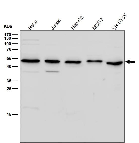 Cytochrome P450 17A1 Ab