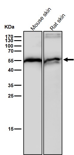 Cytochrome P450 17A1 Ab