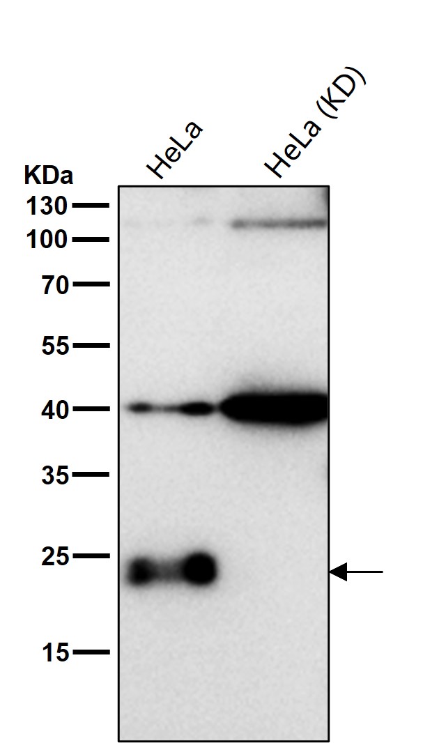 CBF beta Ab