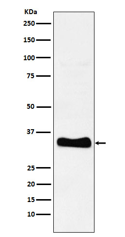 Monoglyceride lipase Ab