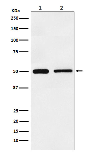 Hepatitis A virus cellular receptor 1 Ab