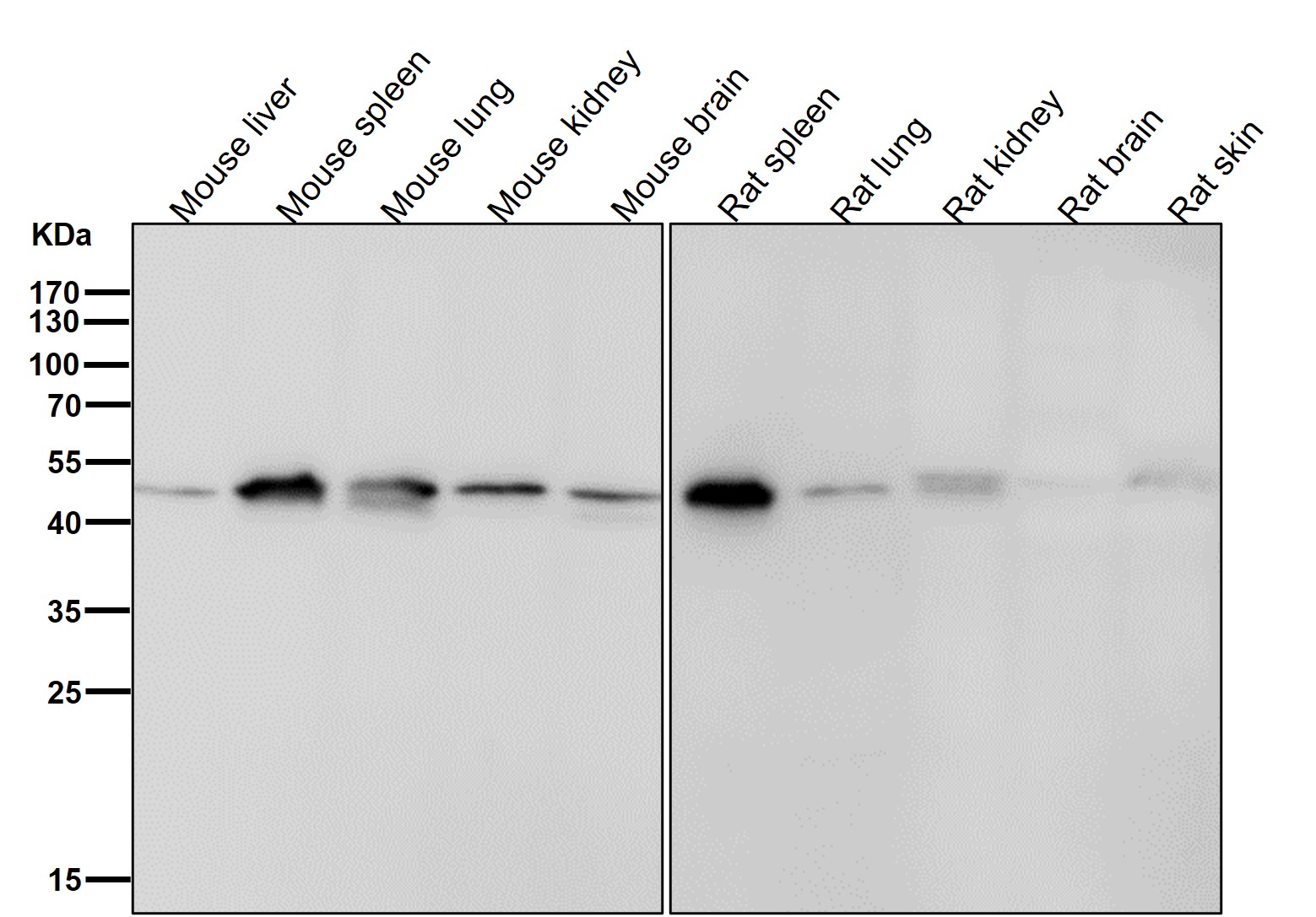 Hepatitis A virus cellular receptor 1 Ab