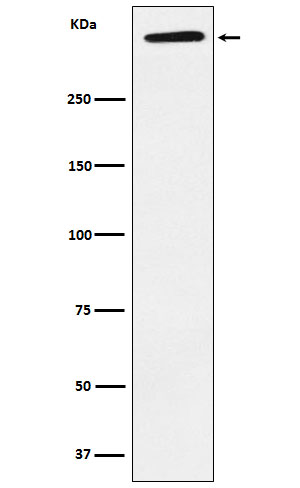 Apolipoprotein A Ab