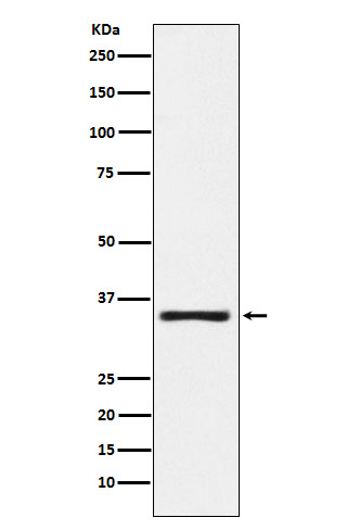 Kallikrein 2 Ab