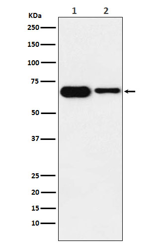 IGF2BP2 Ab