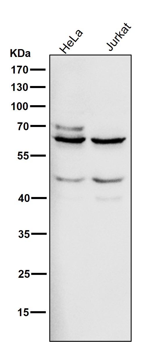 IGF2BP2 Ab