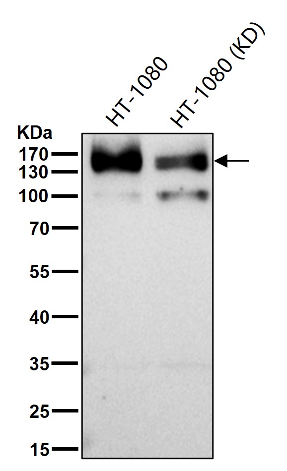 ATP7B Ab