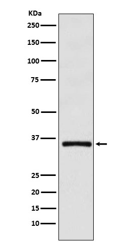 DMRT1 Ab