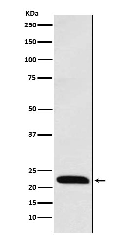 ICOS Ab