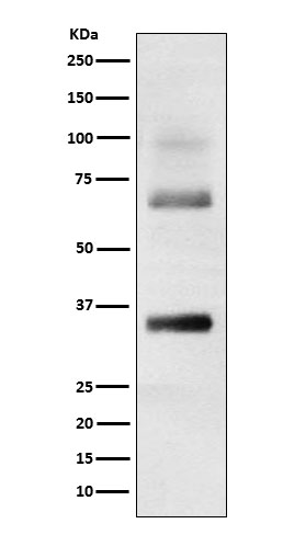 Loricrin Ab