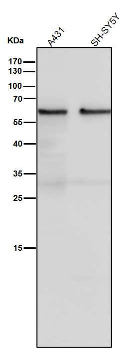 Angiopoietin related protein 3 Ab