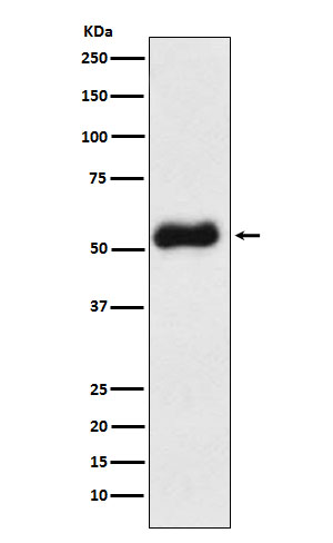 TBXAS1 Ab