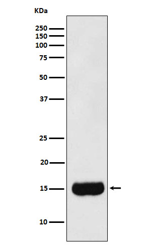 beta 2 Microseminoprotein Ab