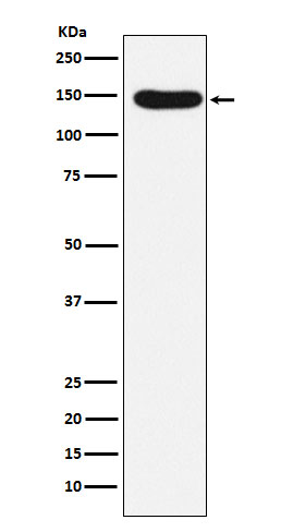 Desmoglein 3 Ab