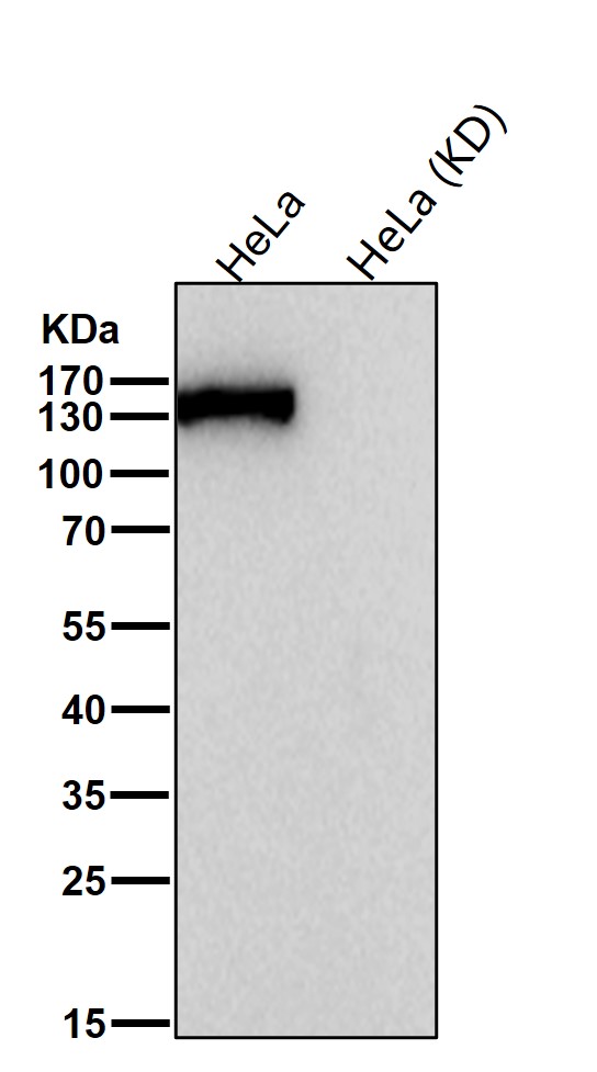 CPS1 Ab