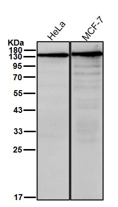 CPS1 Ab