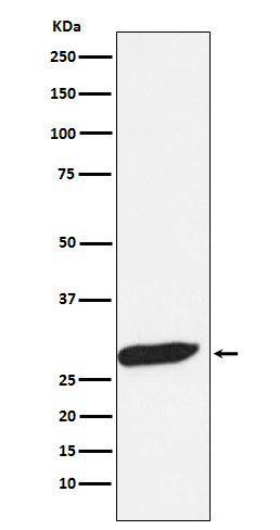 FHL 1 Ab