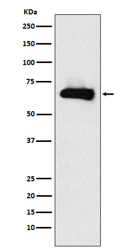 DRP 3 Ab