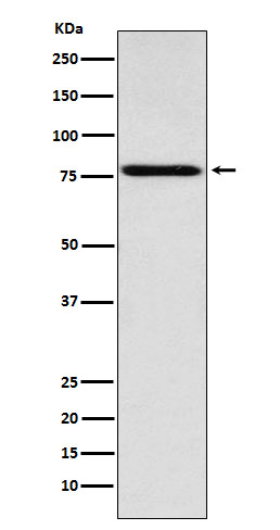 Coilin Ab