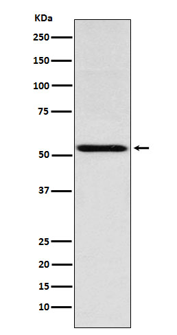 Thyroid hormone receptor alpha Ab