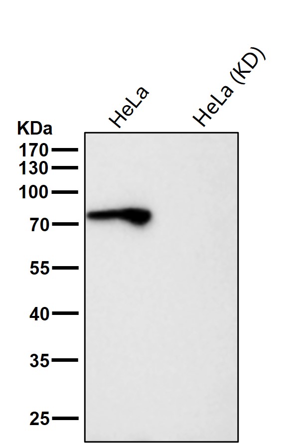 Lysine tRNA ligase Ab