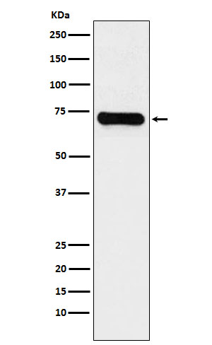 Lysine tRNA ligase Ab