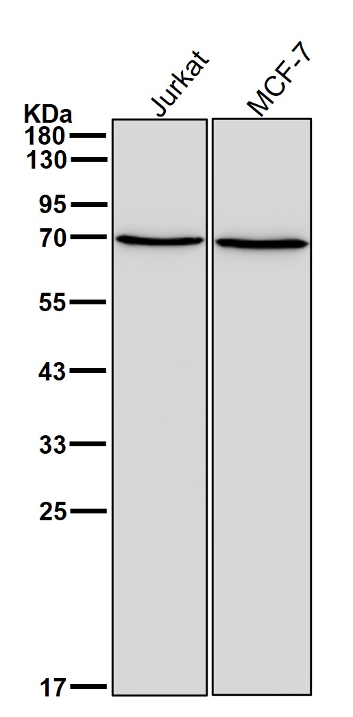 Lysine tRNA ligase Ab