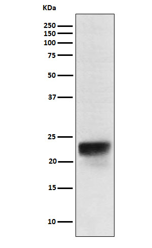 FSH beta Ab