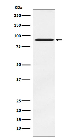 ATR interacting protein Ab