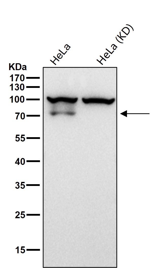 beta Galactosidase Ab