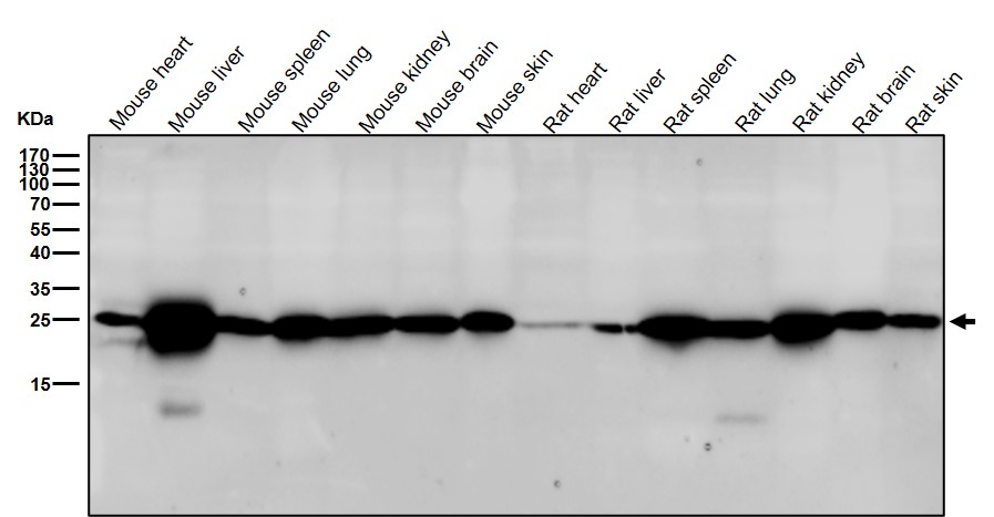 GSTP1 Ab