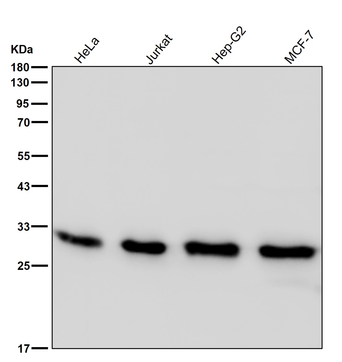 Glutathione S transferase omega 1 Ab