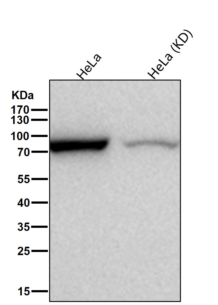 RRM1 Ab