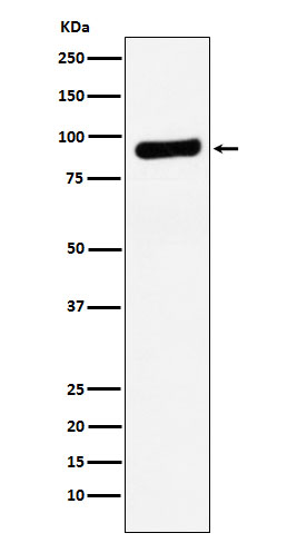 RRM1 Ab