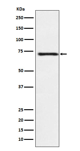 GCS beta 1 Ab