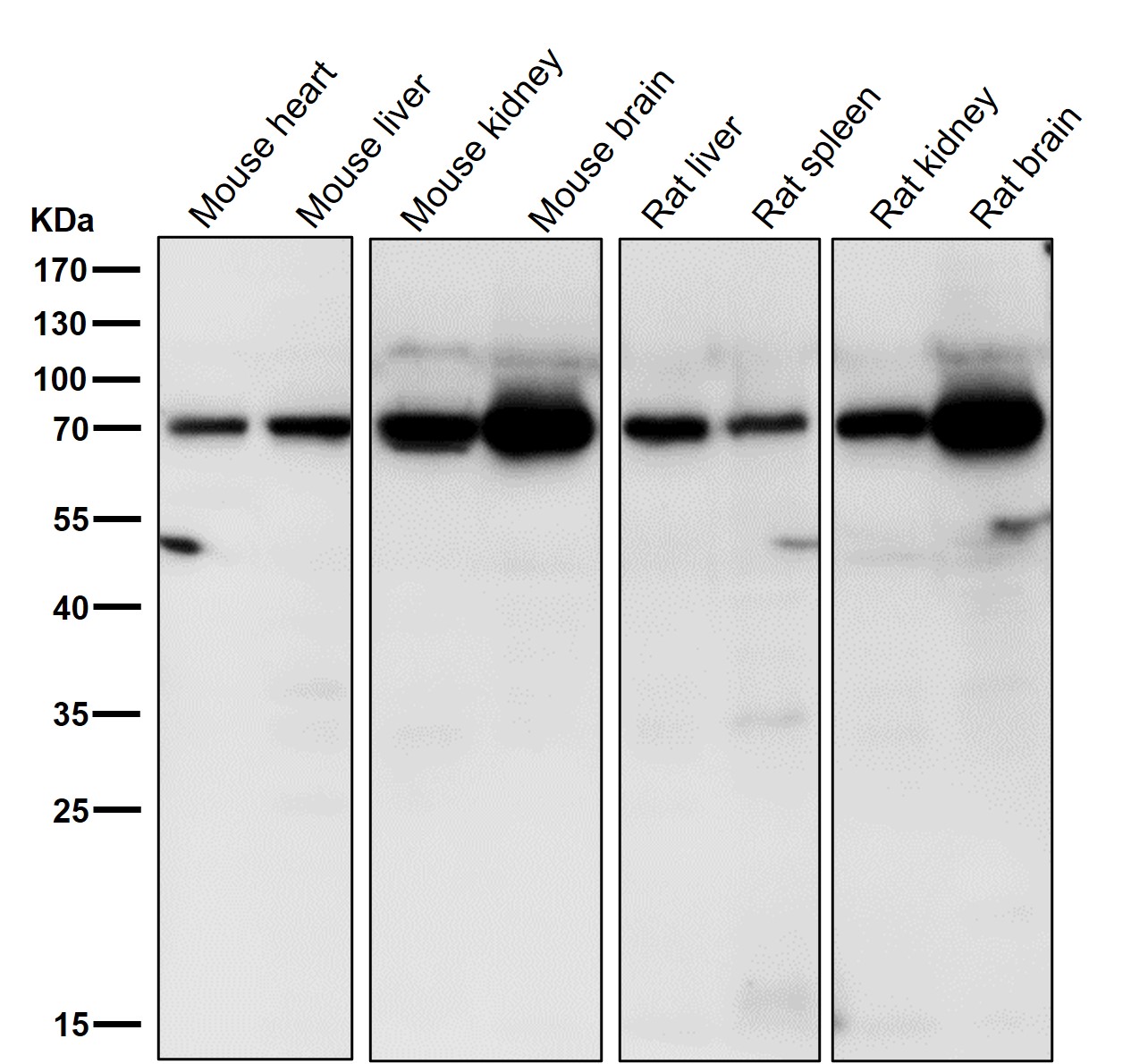 GCS beta 1 Ab